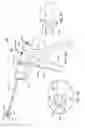 Fig. 06 - TISSUE REMOVAL DEVICE WITH TISSUE GRIP