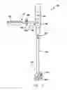 Fig. 07 - Inside-out guide for hip replacement method