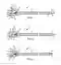 Fig. 02 - Fast-acting or rotating transseptal needle