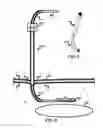 Fig. 05 - NESTED CANNULA DEVICE FOR LUNG COLLAPSE