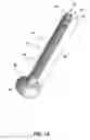 Fig. 02 - Transabdominal gastric device and method