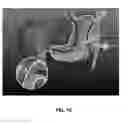 Fig. 22 - Transabdominal gastric device and method