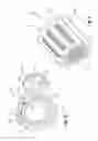 Fig. 08 - Remotely adjustable tissue displacement device