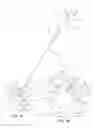 Fig. 06 - Systems and methods for posterior dynamic stabilization of the spine