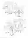 Fig. 10 - Systems and methods for posterior dynamic stabilization of the spine