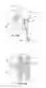 Fig. 15 - Systems and methods for posterior dynamic stabilization of the spine