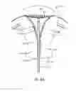 Fig. 09 - Systems and methods for endometrial ablation
