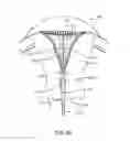 Fig. 10 - Systems and methods for endometrial ablation