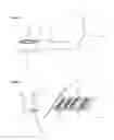 Fig. 07 - DENTAL TOOL COMPRISING A VERSATILE TIP