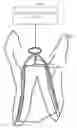 Fig. 01 - Pressure Wave Root Canal Cleaning System