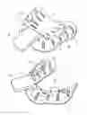 Fig. 01 - Impression tray set for edentulous jaw