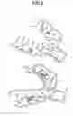 Fig. 03 - Impression tray set for edentulous jaw