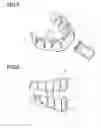 Fig. 05 - Impression tray set for edentulous jaw