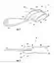 Fig. 02 - REUSABLE DENTAL IMPRESSION TRAY