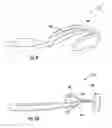 Fig. 06 - REUSABLE DENTAL IMPRESSION TRAY