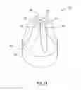 Fig. 07 - UROLOGICAL DEVICE