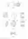 Fig. 10 - VASCULAR FILTER DEVICE