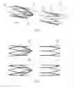 Fig. 14 - VASCULAR FILTER DEVICE
