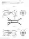 Fig. 23 - VASCULAR FILTER DEVICE
