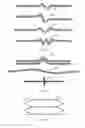 Fig. 28 - VASCULAR FILTER DEVICE