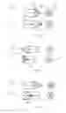 Fig. 30 - VASCULAR FILTER DEVICE