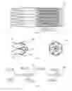 Fig. 33 - VASCULAR FILTER DEVICE