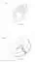 Fig. 44 - VASCULAR FILTER DEVICE