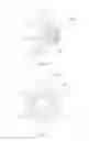 Fig. 57 - VASCULAR FILTER DEVICE