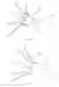Fig. 70 - VASCULAR FILTER DEVICE