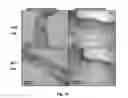 Fig. 13 - Bioerodible wraps and uses therefor