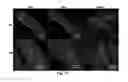 Fig. 14 - Bioerodible wraps and uses therefor