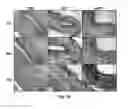 Fig. 15 - Bioerodible wraps and uses therefor