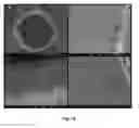 Fig. 16 - Bioerodible wraps and uses therefor