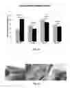 Fig. 23 - Bioerodible wraps and uses therefor