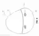 Fig. 09 - Implantable prosthesis having acellular tissue attachments