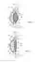 Fig. 02 - ACCOMMODATING INTRAOCULAR LENS ASSEMBLIES AND ACCOMMODATION MEASUREMENT IMPLANT