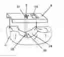 Fig. 01 - Method for manufacturing a template to adapt the shape of a bone defect in a jaw to a bone superstructure