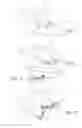 Fig. 02 - Method for manufacturing a template to adapt the shape of a bone defect in a jaw to a bone superstructure
