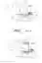 Fig. 03 - Method for manufacturing a template to adapt the shape of a bone defect in a jaw to a bone superstructure