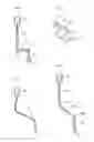 Fig. 04 - Hip joint method