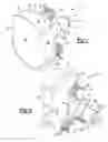 Fig. 02 - Patient-Specific Glenoid Implant