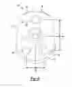 Fig. 04 - Patient-Specific Glenoid Implant