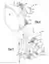 Fig. 05 - Patient-Specific Glenoid Implant