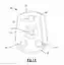 Fig. 07 - Patient-Specific Glenoid Implant