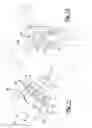 Fig. 08 - Patient-Specific Glenoid Implant