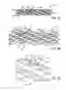 Fig. 04 - Low profile stent with flexible link