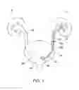 Fig. 02 - STENT PUSHER ASSEMBLY