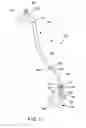 Fig. 03 - STENT PUSHER ASSEMBLY