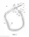 Fig. 04 - STENT PUSHER ASSEMBLY