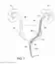 Fig. 09 - STENT PUSHER ASSEMBLY